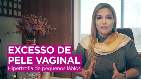 labios vaginales grandes|Un enemigo oculto entre tus piernas: la hipertrofia vaginal